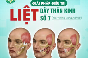 Giải Pháp Điều Trị Liệt Dây Thần Kinh Số 7 Tại Phương Đông Inomas