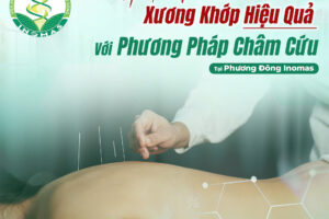 Giải Pháp Chữa Đau Nhức Xương Khớp Hiệu Quả Với Phương Pháp Châm Cứu