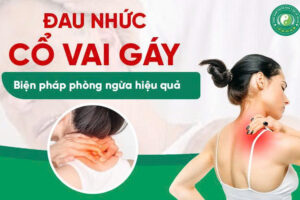 ĐAU CỔ VAI GÁY – BIỆN PHÁP PHÒNG NGỪA HIỆU QUẢ