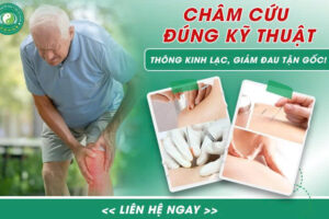 CHÂM CỨU DÙNG KỸ THUẬT THÔNG KINH LẠC – GIẢI PHÁP GIẢM ĐAU HIỆU QUẢ, AN TOÀN TỪ Y HỌC CỔ TRUYỀN