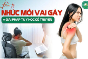 NHỨC MỎI VAI GÁY – NGUYÊN NHÂN, TRIỆU CHỨNG VÀ CÁCH KHẮC PHỤC HIỆU QUẢ