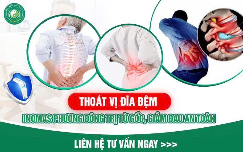 THOÁT VỊ ĐĨA ĐỆM – TRỊ TẬN GỐC, GIẢM ĐAU AN TOÀN TẠI INOMAS PHƯƠNG ĐÔNG