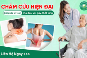 CHÂM CỨU – GIẢI PHÁP AN TOÀN, HIỆU QUẢ CHO ĐAU VAI GÁY, ĐAU THẮT LƯNG