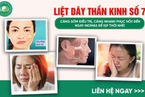 LIỆT DÂY THẦN KINH SỐ 7 – NGUYÊN NHÂN, TRIỆU CHỨNG VÀ HƯỚNG ĐIỀU TRỊ HIỆU QUẢ BẰNG Y HỌC CỔ TRUYỀN