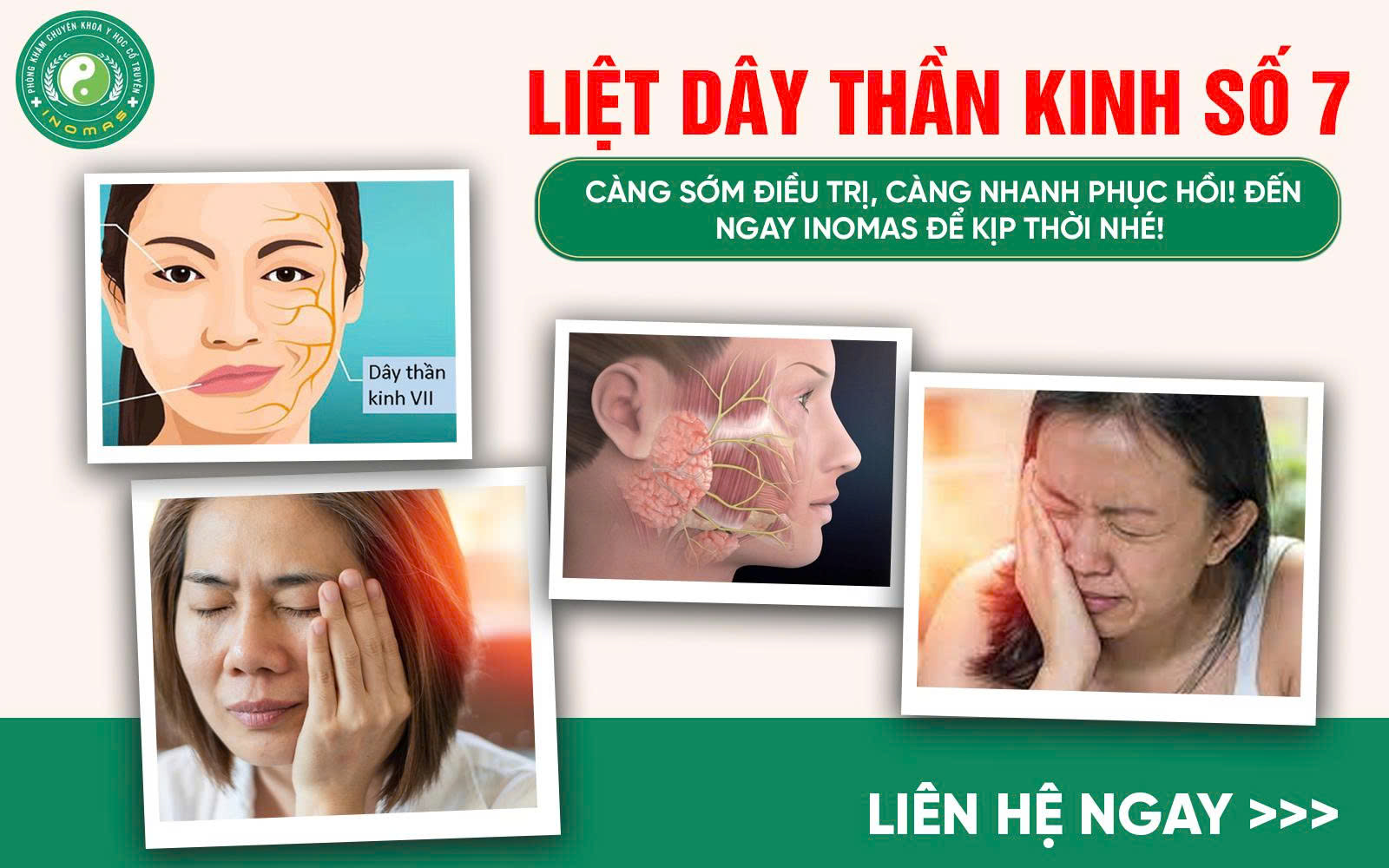 LIỆT DÂY THẦN KINH SỐ 7 – NGUYÊN NHÂN, TRIỆU CHỨNG VÀ HƯỚNG ĐIỀU TRỊ HIỆU QUẢ BẰNG Y HỌC CỔ TRUYỀN