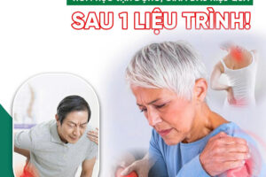 CHÂM CỨU TRỊ ĐAU VAI GÁY – HỒI PHỤC VẬN ĐỘNG, GIẢM ĐAU SAU 1 LIỆU TRÌNH