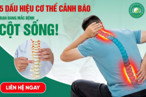 5 Dấu Hiệu Cảnh Báo Bạn Đang Mắc Bệnh Cột Sống – Chớ Bỏ Qua!
