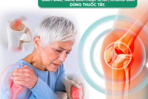 ĐAU KHỚP GỐI – THOÁI HÓA KHỚP: GIẢM ĐAU, TĂNG LINH HOẠT KHỚP – KHÔNG CẦN DÙNG THUỐC TÂY!