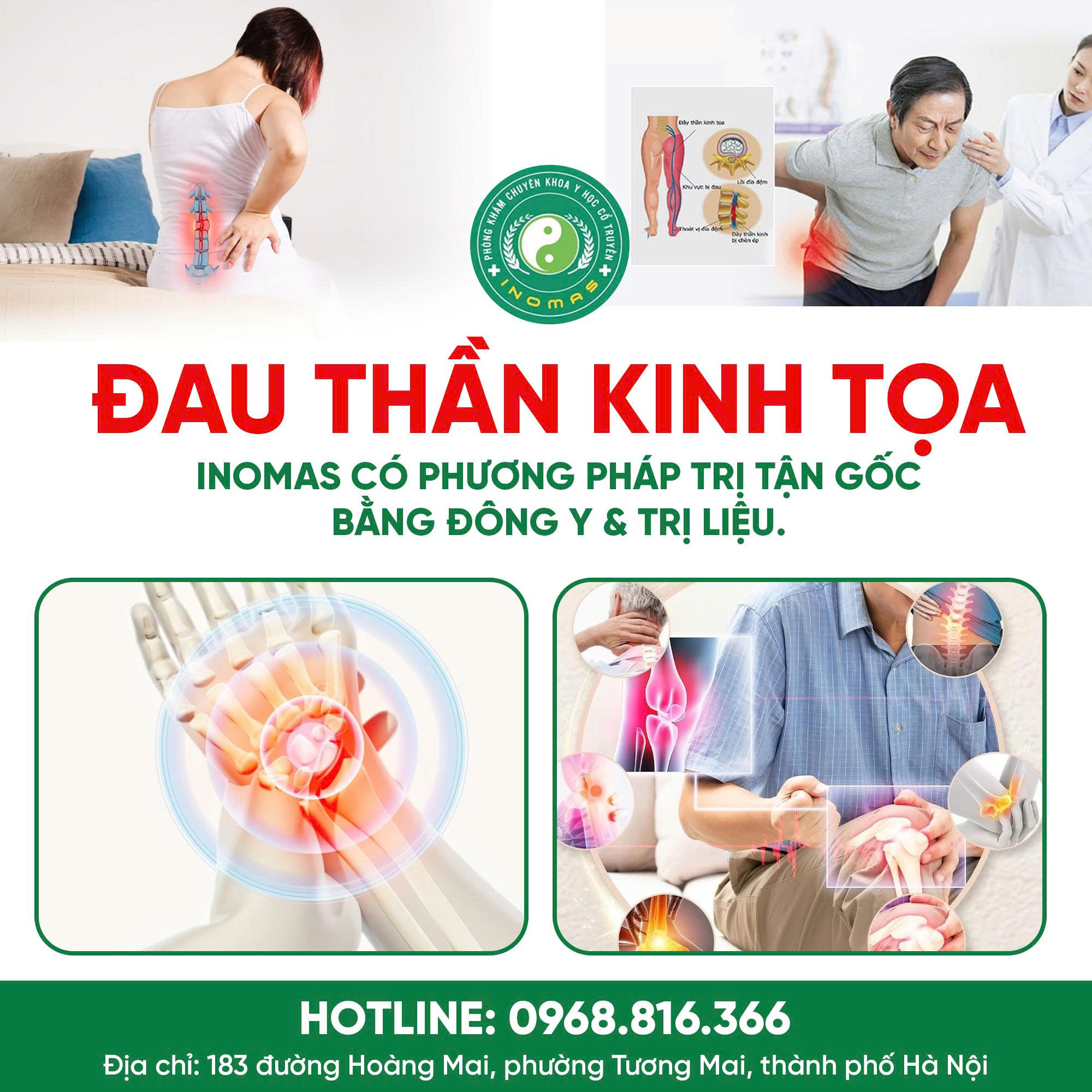 ĐAU THẦN KINH TỌA – ĐỪNG CHỊU ĐỰNG THÊM!
