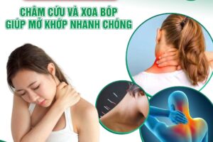 Trị liệu đau vai gáy – Khắc phục nhức mỏi do ngồi lâu, làm việc căng thẳng