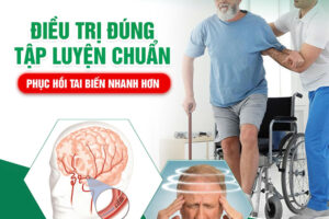 Điều trị đúng – Tập luyện chuẩn – Phục hồi tai biến nhanh hơn