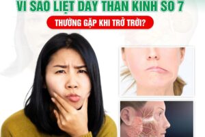 VÌ SAO LIỆT DÂY THẦN KINH SỐ 7 THƯỜNG GẶP KHI TRỞ TRỜI?