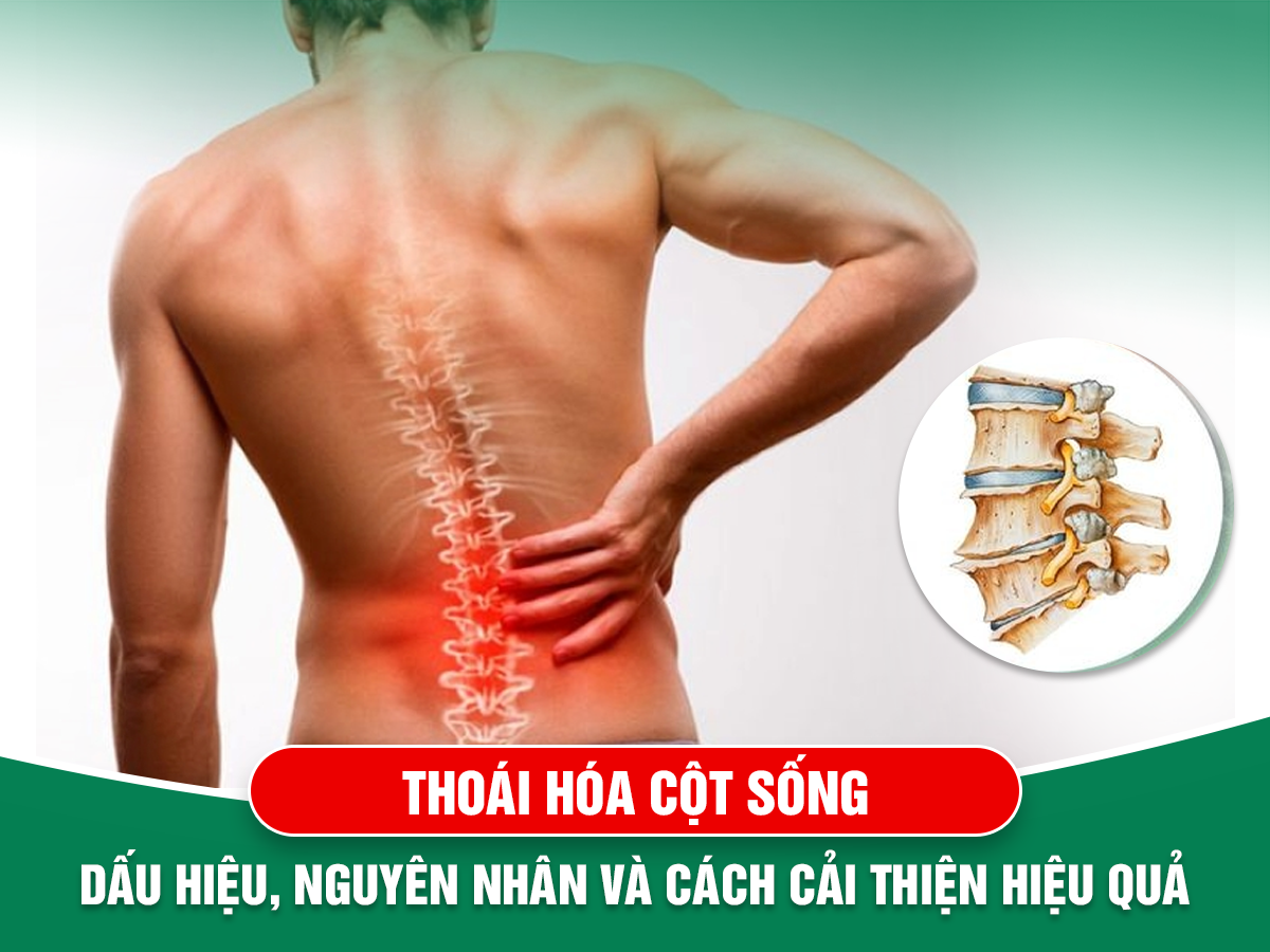 Thoái hóa cột sống