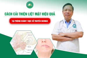 Liệt Mặt: Dấu Hiệu Nhận Biết Và Cách Cải Thiện Sớm
