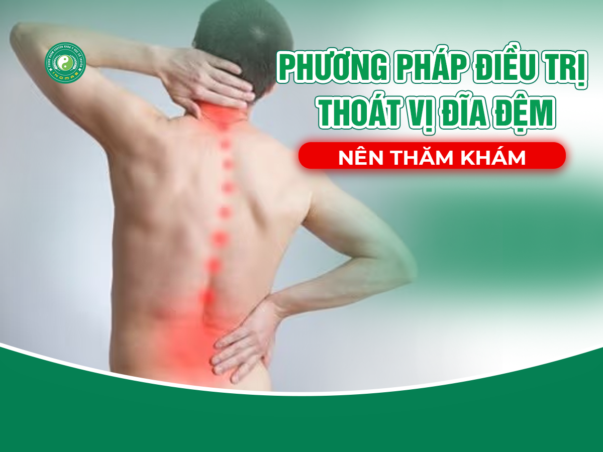 Thoát vị đĩa đệm: Dấu hiệu và phương pháp