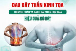 Đau Dây Thần Kinh Tọa: Nguyên Nhân Và Cách Cải Thiện Hiệu Quả