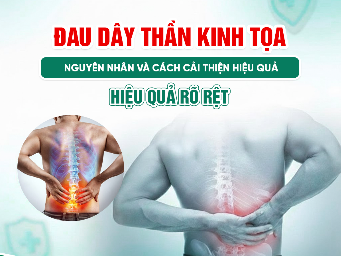 Đau dây thần kinh tọa