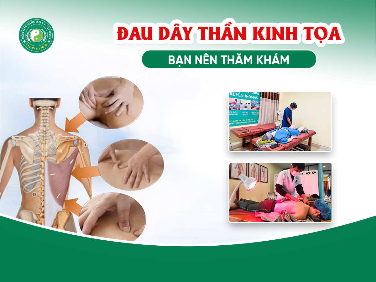 Đau dây thần kinh tọa