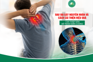 Đau Vai Gáy Nguyên Nhân Và Cách Cải Thiện Hiệu Quả