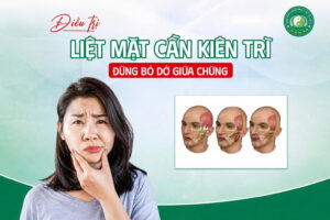 Điều trị liệt mặt cần kiên trì đừng bỏ dở giữa chừng