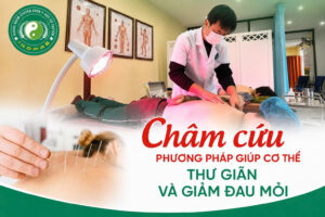 Châm Cứu: Giúp Cơ Thể Thư Giãn Và Giảm Đau Mỏi