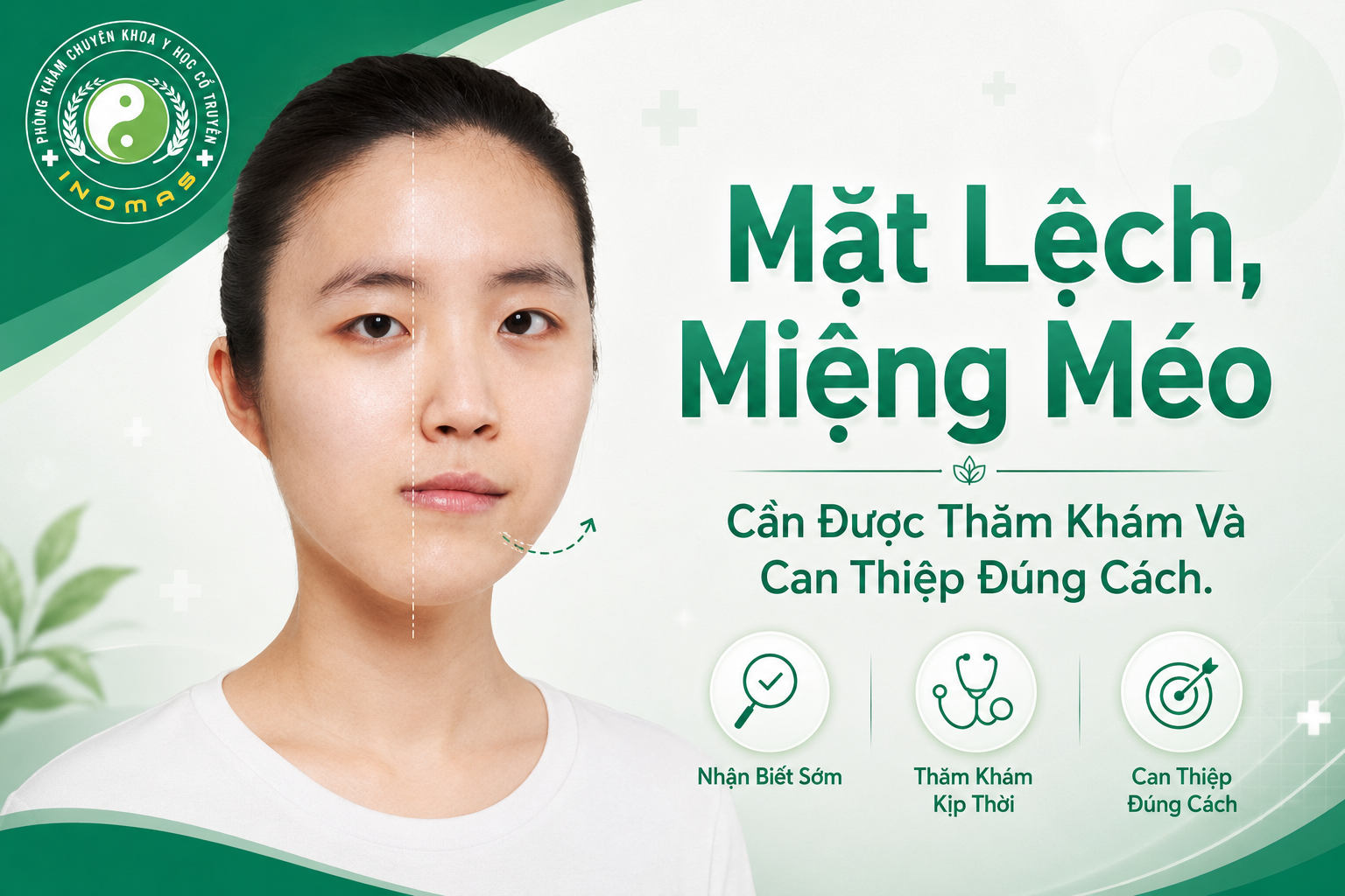 Mặt Lệch, Miệng Méo – Cần Được Thăm Khám Và Can Thiệp Đúng Cách