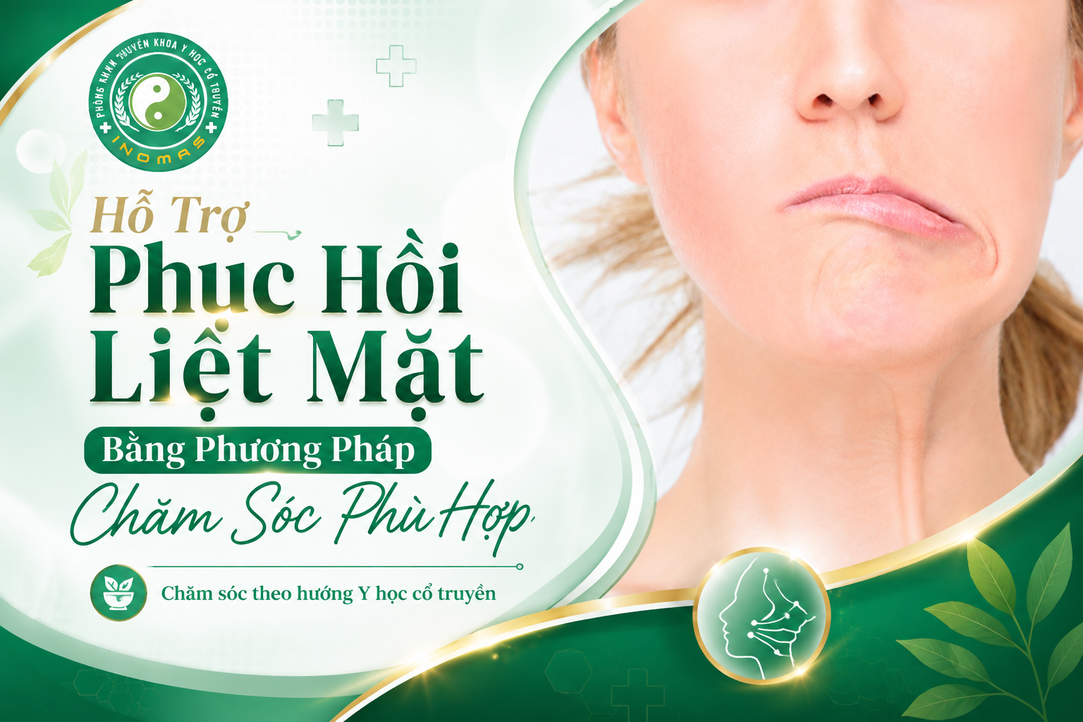 Hỗ Trợ Phục Hồi Liệt Mặt Bằng Phương Pháp Chăm Sóc Phù Hợp