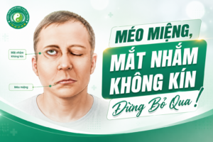 Méo Miệng, Mắt Nhắm Không Kín Đừng Bỏ Qua
